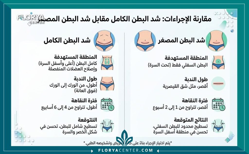 شد البطن المصغر 3 إنفوجرافيك يقارن بين شد البطن الكامل وشد البطن المصغر من حيث حجم الندبة، فترة التعافي، والمنطقة المستهدفة.