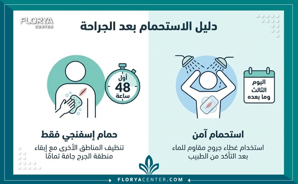 إنفوجرافيك يوضح الجدول الزمني ومتى يمكن الاستحمام بعد عملية شد الجسم.