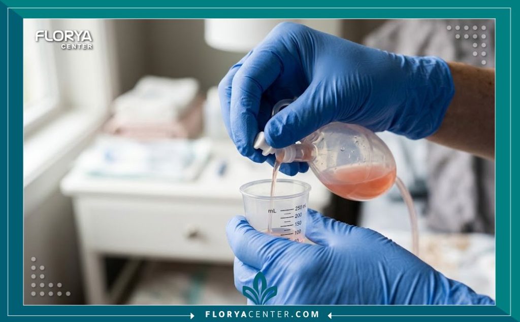 طريقة العناية بأنابيب التصريف (الدرنقة) في المنزل 5 الطريقة الصحيحة لتفريغ الدرنقة الجراحية في كوب القياس مع الحفاظ على التعقيم.