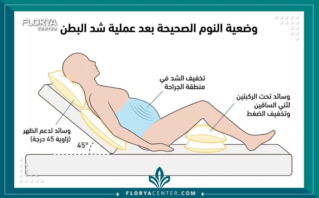 رسم توضيحي طبي يشرح الطريقة الصحيحة للنوم بعد عملية شد البطن لتقليل الشد على الجرح.