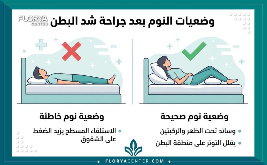 إنفوجرافيك يقارن بين طريقة النوم الصحيحة والخاطئة بعد جراحة شد البطن لضمان التعافي السليم.