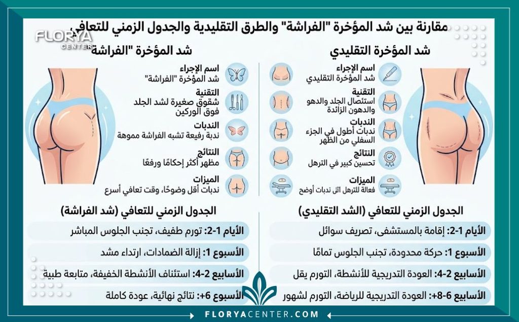 عملية شد المؤخرة الفراشية (Butterfly Butt Lift) 3 إنفوجرافيك طبي يقارن بين عملية شد المؤخرة الفراشية وطرق شد الأرداف التقليدية مع توضيح مراحل التعافي والنتائج.