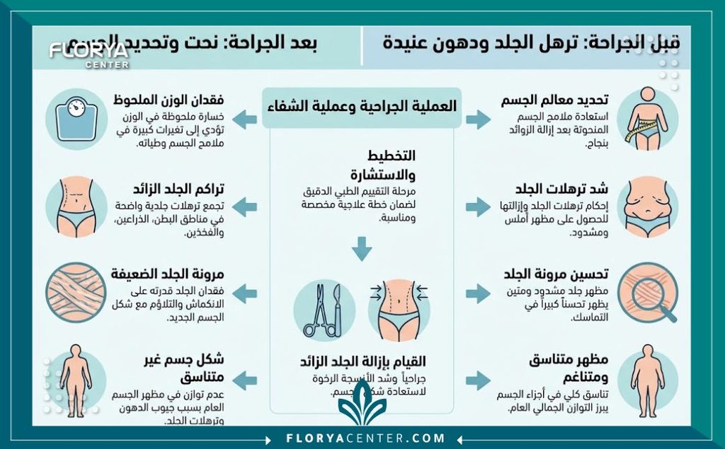 إنفوجرافيك يشرح خطوات ومراحل التعافي من عملية قص الجلد الفائض بعد التكميم أو النحافة.