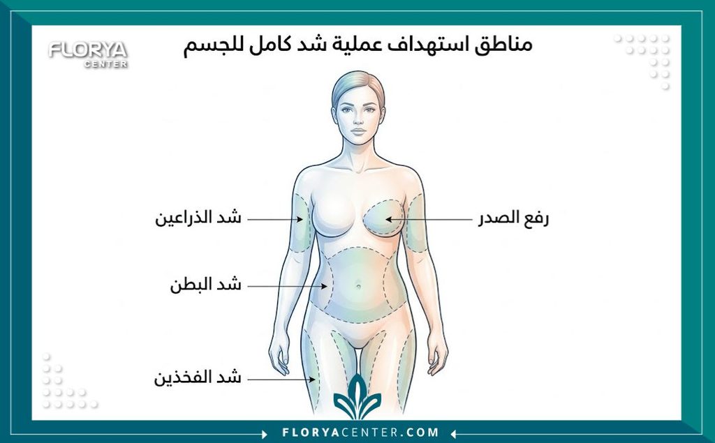 رسم توضيحي طبي يظهر المناطق المستهدفة في عملية شد الجسم الكامل لتوضيح طبيعة التعافي