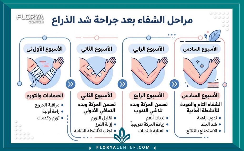 إنفوجرافيك يوضح بالتفصيل مراحل تعافي جروح شد الذراعين أسبوعياً من الجراحة وحتى التئام الندبة.