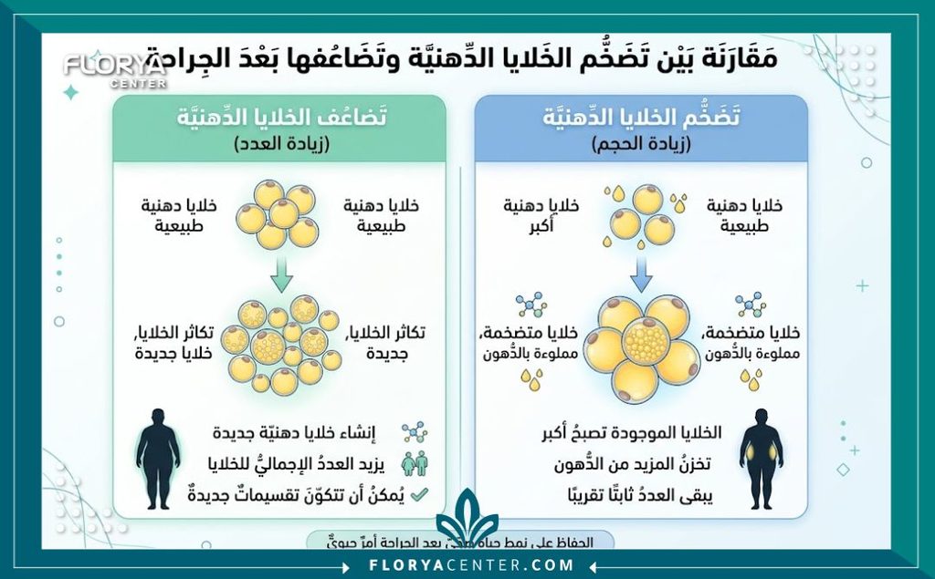 إنفوجرافيك يشرح حقيقة الوزن بعد عملية استئصال الجلد الزائد وتمدد الخلايا الدهنية في مناطق أخرى بعد عملية شد الترهلات.