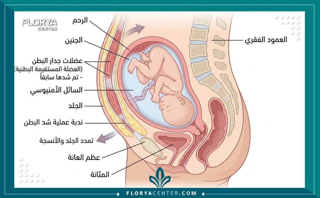 رسم توضيحي طبي دقيق يوضح تشريح عضلات البطن والرحم، وكيف يتمدد الجلد بأمان أثناء الحمل بعد جراحة شد البطن.