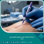 صورة مقربة تظهر دقة استخدام الغراء الطبي الحيوي ديرمابوند لإغلاق جروح الشد التجميلية بدون خياطة خارجية.