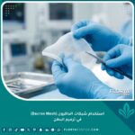 طبيب جراح يمسك بشبكة داكرون طبية (Dacron Mesh) المستخدمة في جراحات ترميم البطن وعلاج الندبات التضخمية.
