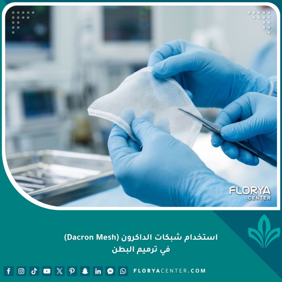 طبيب جراح يمسك بشبكة داكرون طبية (Dacron Mesh) المستخدمة في جراحات ترميم البطن وعلاج الندبات التضخمية.