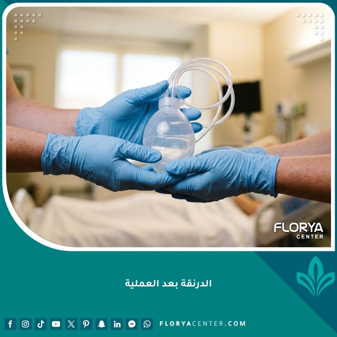 صورة مقربة توضح شكل الدرنقة بعد العملية الجراحية في يد ممرضة، تبرز شكل الأنبوب البلاستيكي الشفاف وخزان السوائل بشكل يبعث على الاطمئنان.