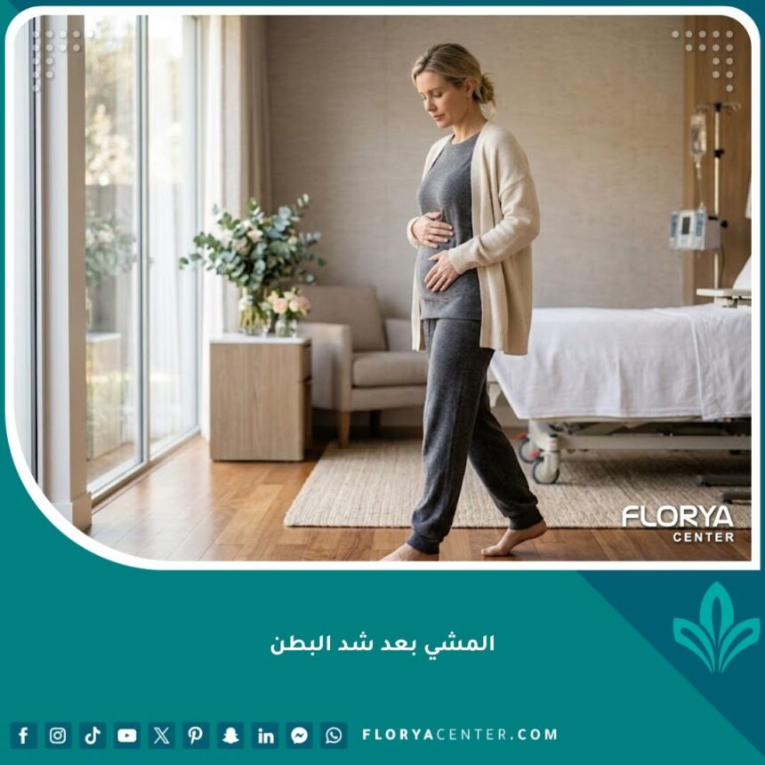 المشي بعد شد البطن 1 امرأة تمشي بظهر منحنٍ قليلاً في فترة التعافي بعد عملية شد البطن للحفاظ على سلامة الجرح.