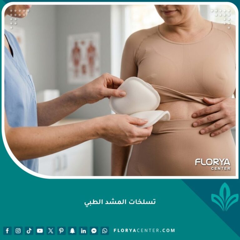 امرأة تضع حشوات إسفنجية طبية ناعمة تحت المشد الطبي لحماية الجلد الضعيف من التسلخات والاحتكاك.