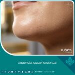 صورة مقربة تظهر دقة النتائج في تقنية الخياطة التجميلية ثلاثية الطبقات حيث تبدو الندبة رقيقة جداً ومخفية تماماً على بشرة نضرة.