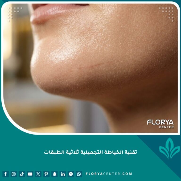 صورة مقربة تظهر دقة النتائج في تقنية الخياطة التجميلية ثلاثية الطبقات حيث تبدو الندبة رقيقة جداً ومخفية تماماً على بشرة نضرة.