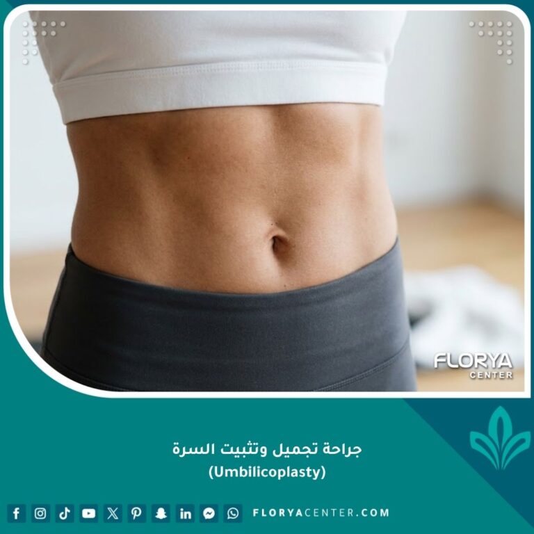 صورة واقعية لبطن رياضي مشدود وسرة غائرة ومثالية تبرز النتائج النهائية لعملية تجميل السرة.