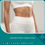 صورة عالية الدقة توضح نتيجة جراحة شد العضلات المائلة الداخلية للخصر للحصول على قوام أنثوي منحوت ومشدود للغاية.