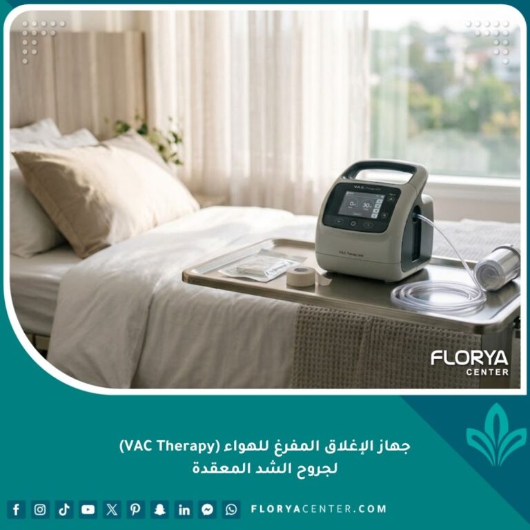 جهاز الإغلاق المفرغ للهواء (VAC Therapy) الحديث في غرفة تعافي فاخرة لعلاج جروح الشد المعقدة.