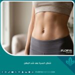 صورة قريبة تبرز شكل السرة المثالي والطبيعي بعد عملية شد البطن، بطن مسطح ومشدود يعكس مهارة الجراح.