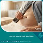 صورة توضيحية تظهر الطريقة الصحيحة لتنظيف السرة بعد عملية شد البطن باستخدام أعواد قطنية معقمة لمنع تراكم الإفرازات.