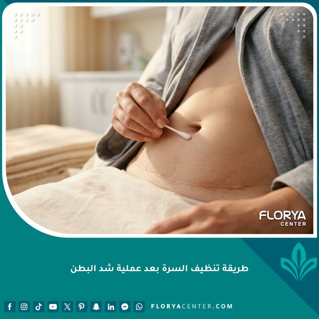 صورة توضيحية تظهر الطريقة الصحيحة لتنظيف السرة بعد عملية شد البطن باستخدام أعواد قطنية معقمة لمنع تراكم الإفرازات.