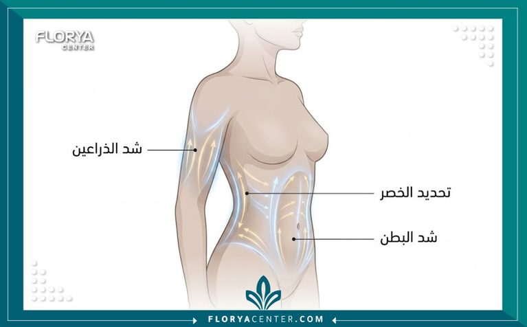 رسم توضيحي طبي يبرز مناطق الجسم المستهدفة في عمليات نحت القوام وشد الترهلات.