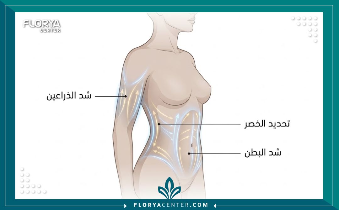 رسم توضيحي طبي يبرز مناطق الجسم المستهدفة في عمليات نحت القوام وشد الترهلات.