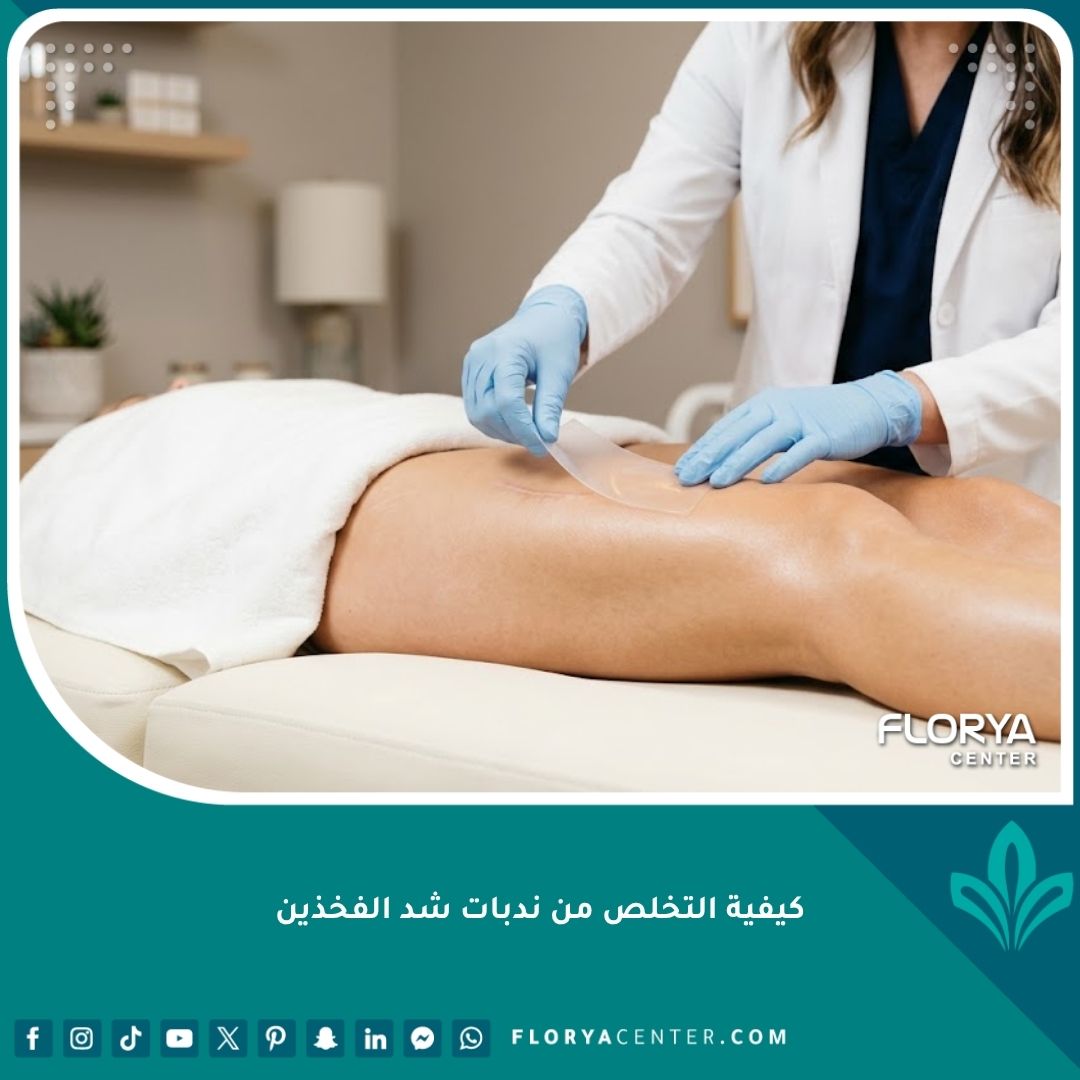 طبيب تجميل يطبق لصقات السيليكون كخطوة أولى في كيفية التخلص من ندبات شد الفخذين وتحسين مظهر الجلد.