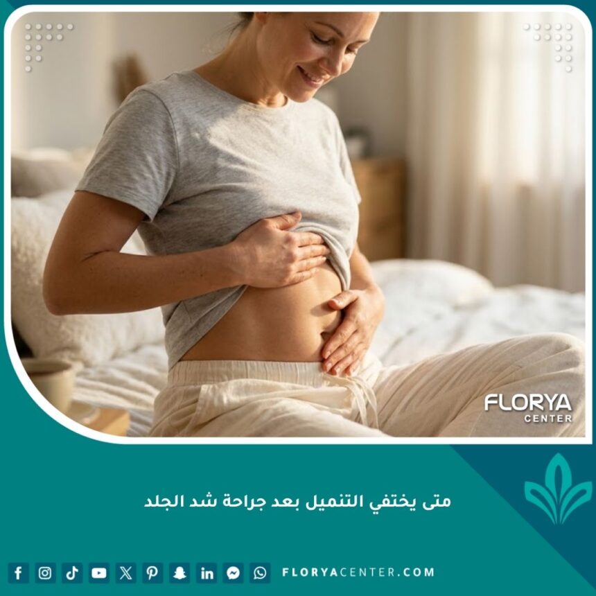 امرأة سعيدة تلمس بشرتها المشدودة براحة تامة بعد التعافي الكامل من جراحة شد الجلد واختفاء التنميل.